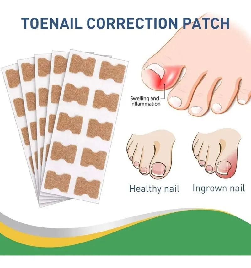 Parches Para El Cuidado De Las Uñas Encarnadas Set De 30pcs