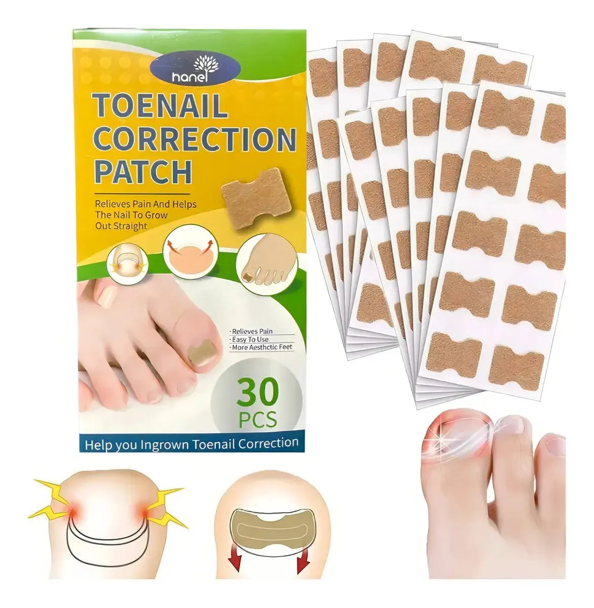 Parches Para El Cuidado De Las Uñas Encarnadas Set De 30pcs